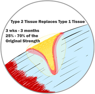 Type 2 Tissue Begins to Replace Type 1 Tissue