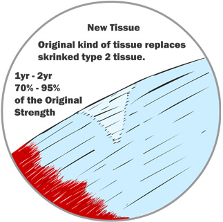 The Original Kind of Tissue Replaces the Shrunk Type 2 Tissue